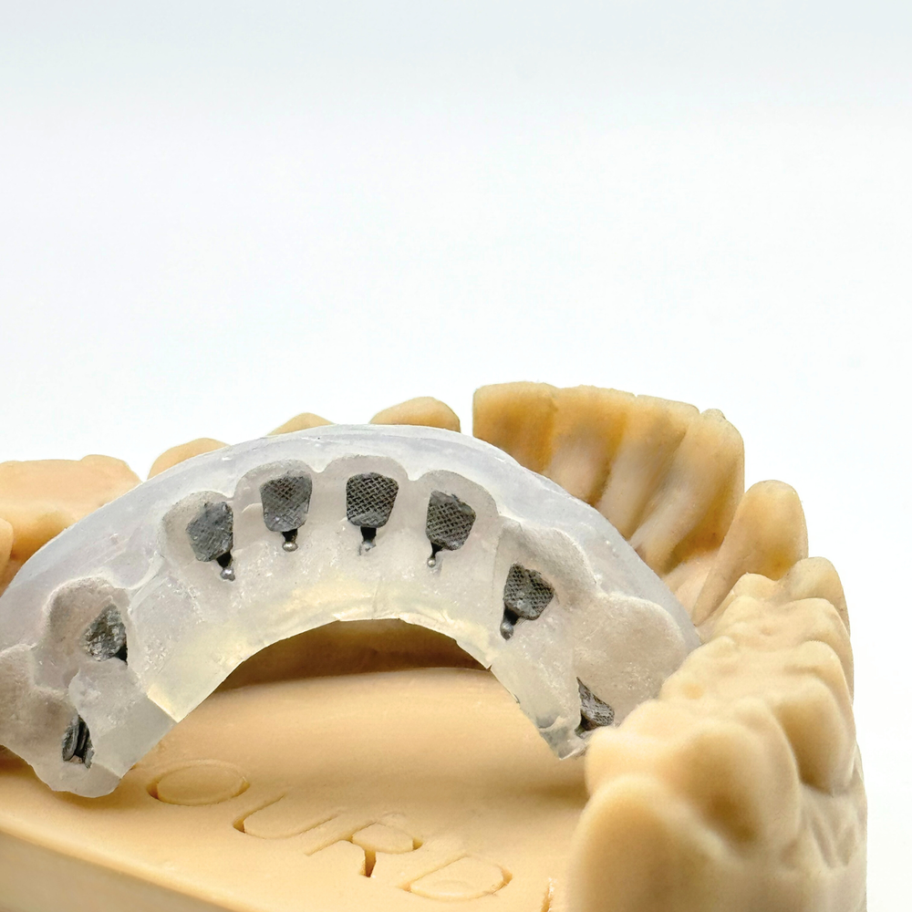 Brackets en collage indirect