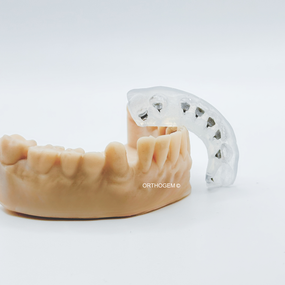Brackets en collage indirect