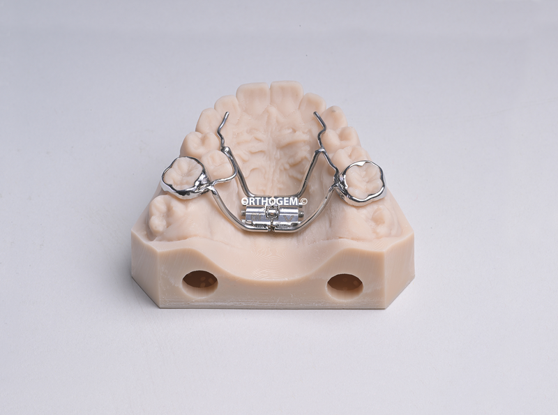 Bagues anatomiques disjoncteur soudé par Orthogem laboratoire ODF prothèse orthodontique innovation