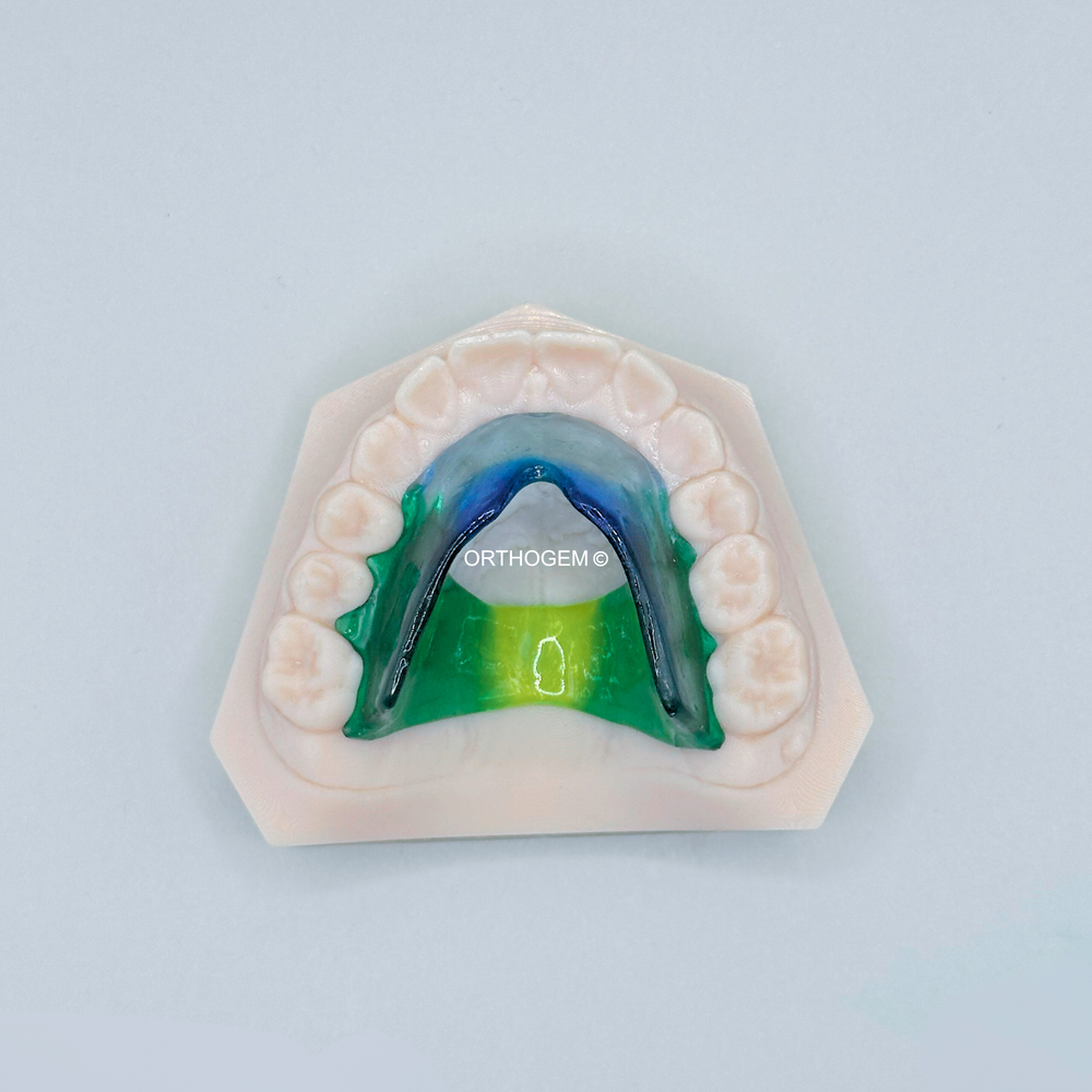 ELN de Bonnet sans crochet