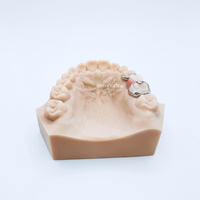 Mainteneur d'espace avec bague anatomique et dent prothétique