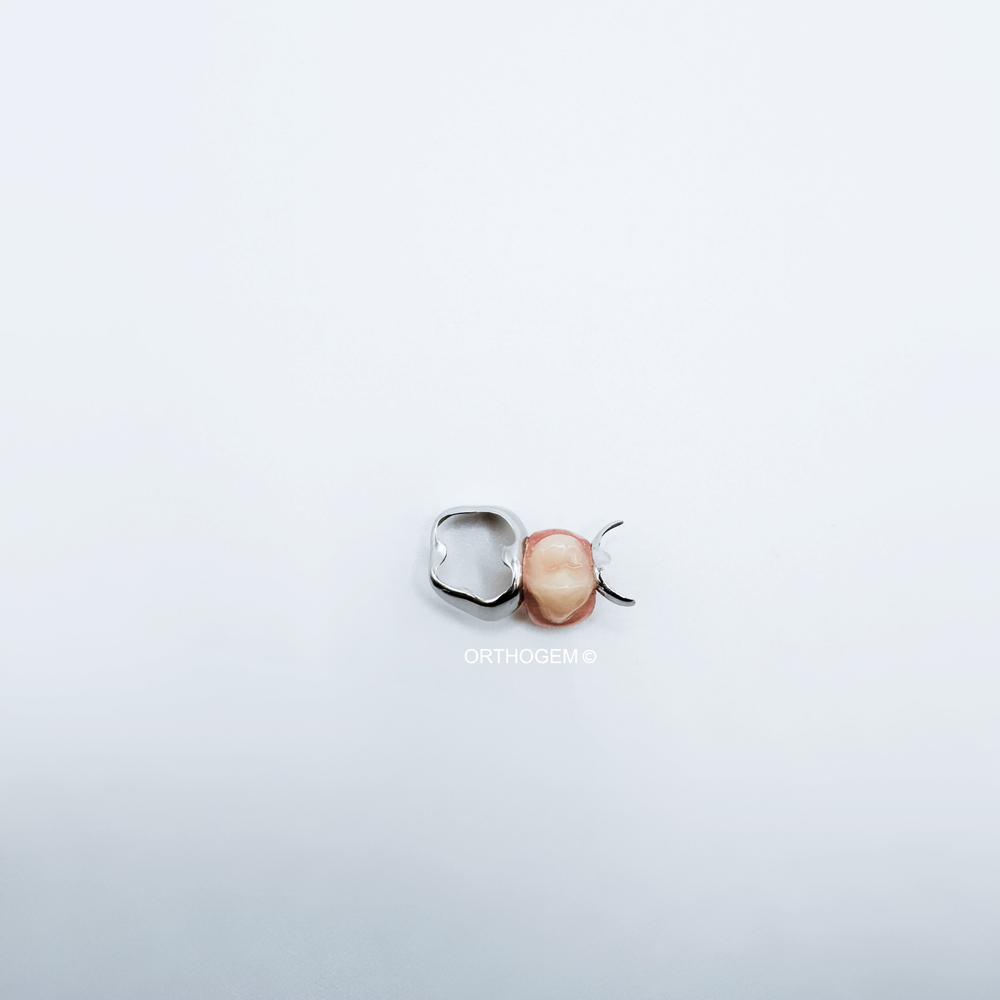 Mainteneur d'espace avec bague anatomique et dent prothétique