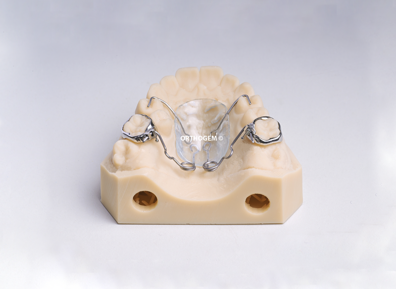 Pendulum soudé sur bagues anatomiques par Orthogem laboratoire ODF et prothèse orthodontique en France qualité réglage rapidité expertise